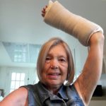 My wrist in heavy cast post-surgery March 30.